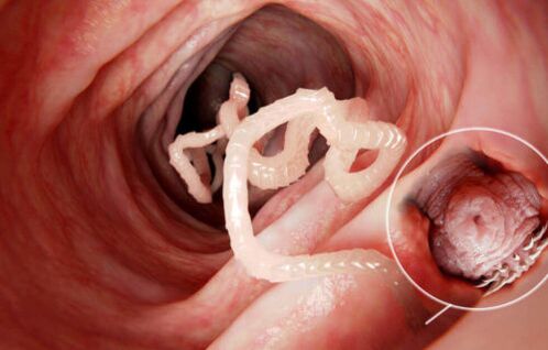 o verme é un parasito no corpo humano